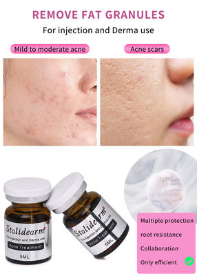 Stalidearm Dermal Fillers Лечение прыщей Инъекционная сыворотка для лечения прыщей и уменьшения пятен