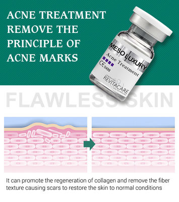 Сыворотка чистого прыща завода ясная забеливая обработку Mesotherapy для шрамов угорь