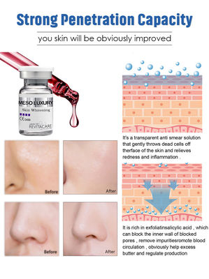РОСКОШНАЯ Meso сыворотка Microneedling немедленно поглотила кожу забеливая суть 10ML