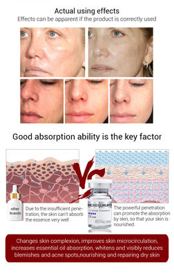 Облегчать укрепляющ Meso сыворотку сути икры Microneedling Mesotheraphy сыворотки