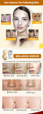 Сыворотка Melasma веснушки удаления Microneedling сыворотки Skincare Meso применяет обложку к забеливать