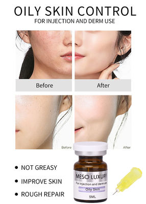 Лечение экзосомами для улучшения состояния кожи MESO Serum Мезотерапевтический раствор для жирной кожи