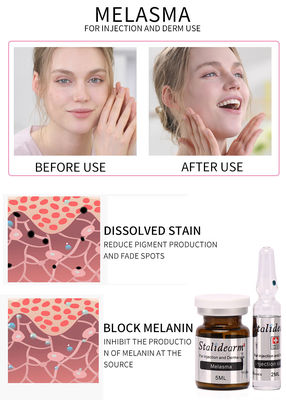 Сейф сыворотки пользы впрыски Melasma и хороший набор сыворотки Mesotherapy 5ml/bottle влияния